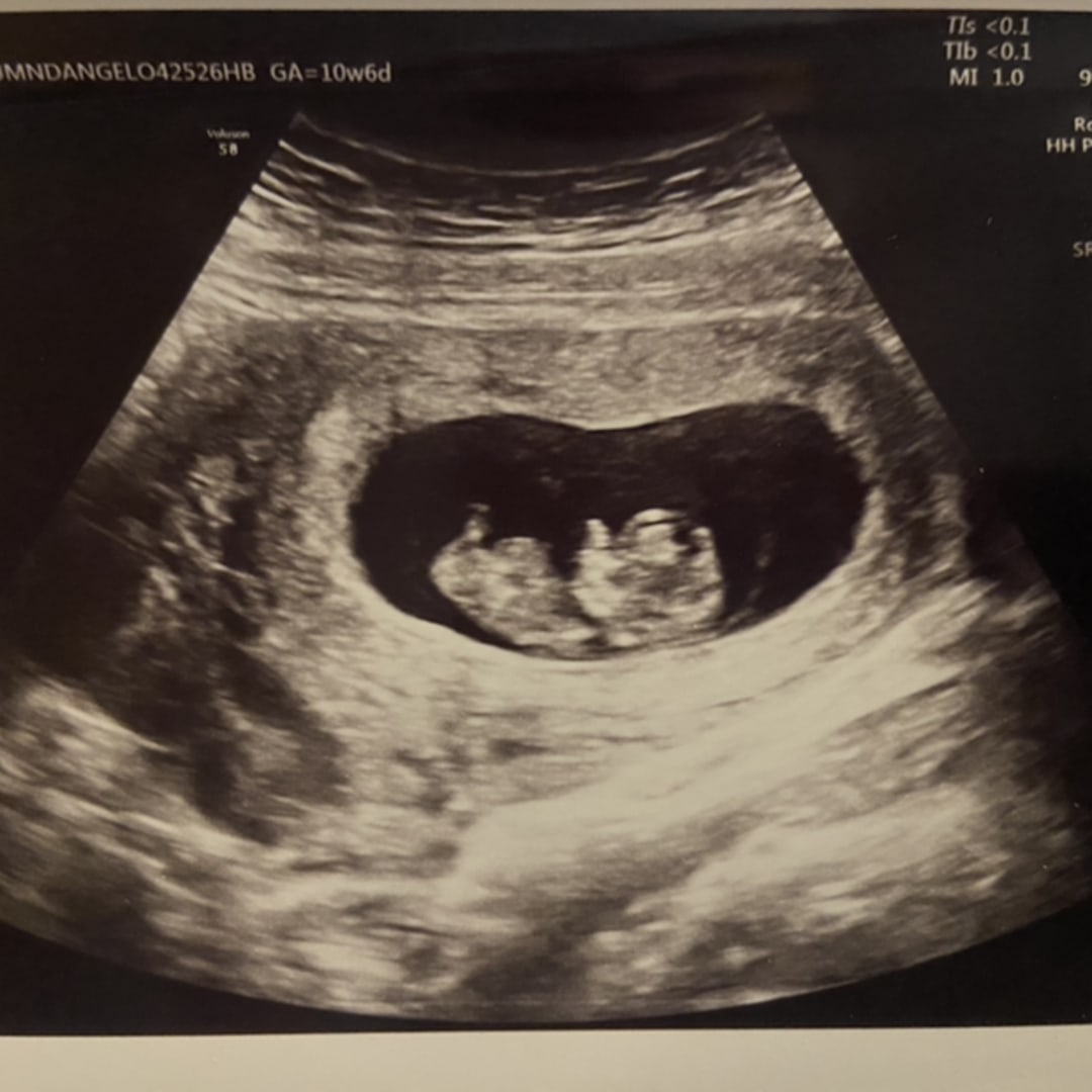 Photo shared by Autumn for their Babylist baby registry.