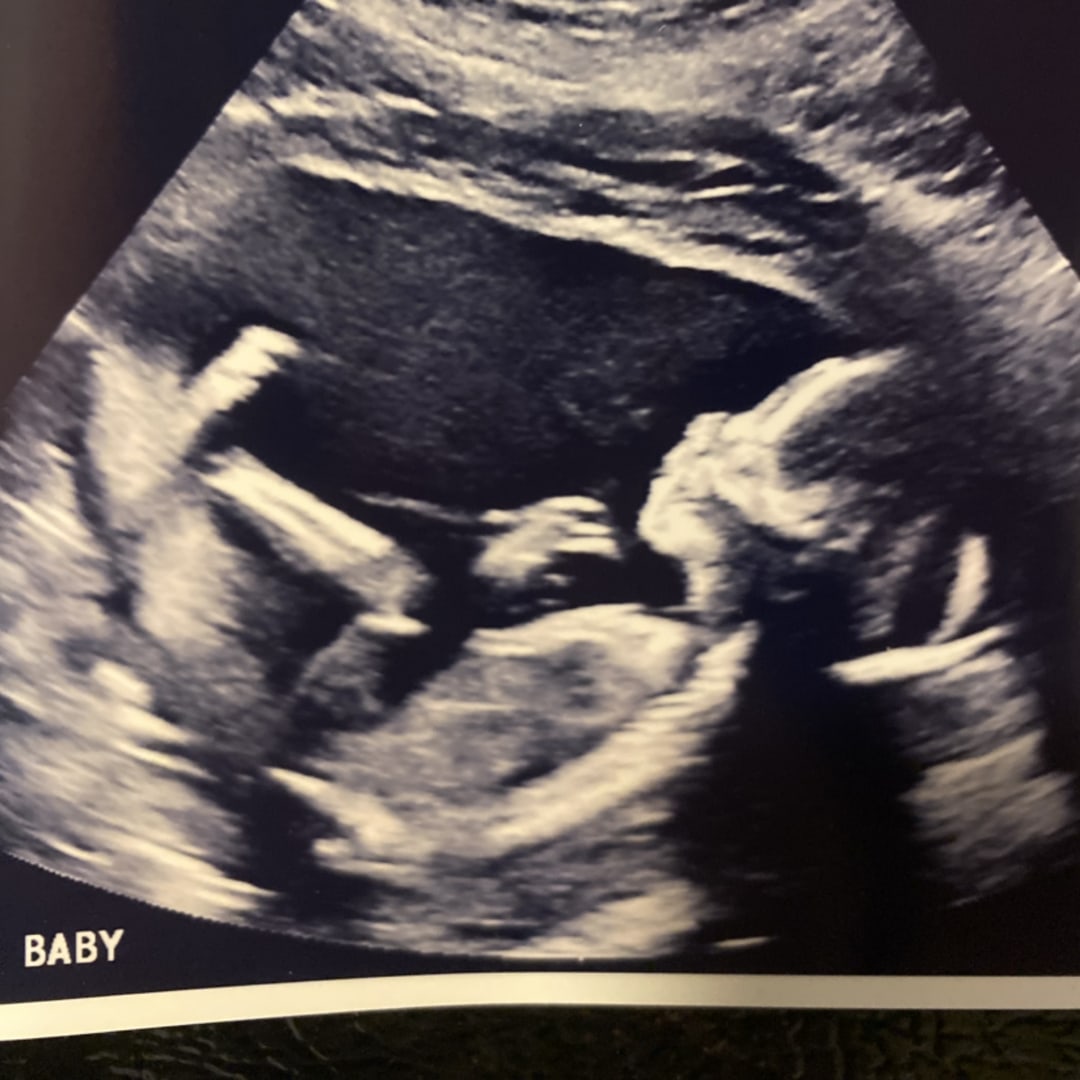 Photo shared by Kaitlyn and Marshall for their Babylist baby registry.