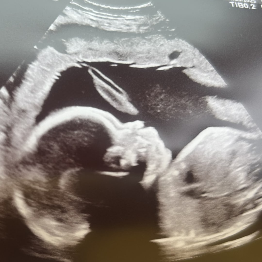 Photo shared by Jai for their Babylist baby registry.