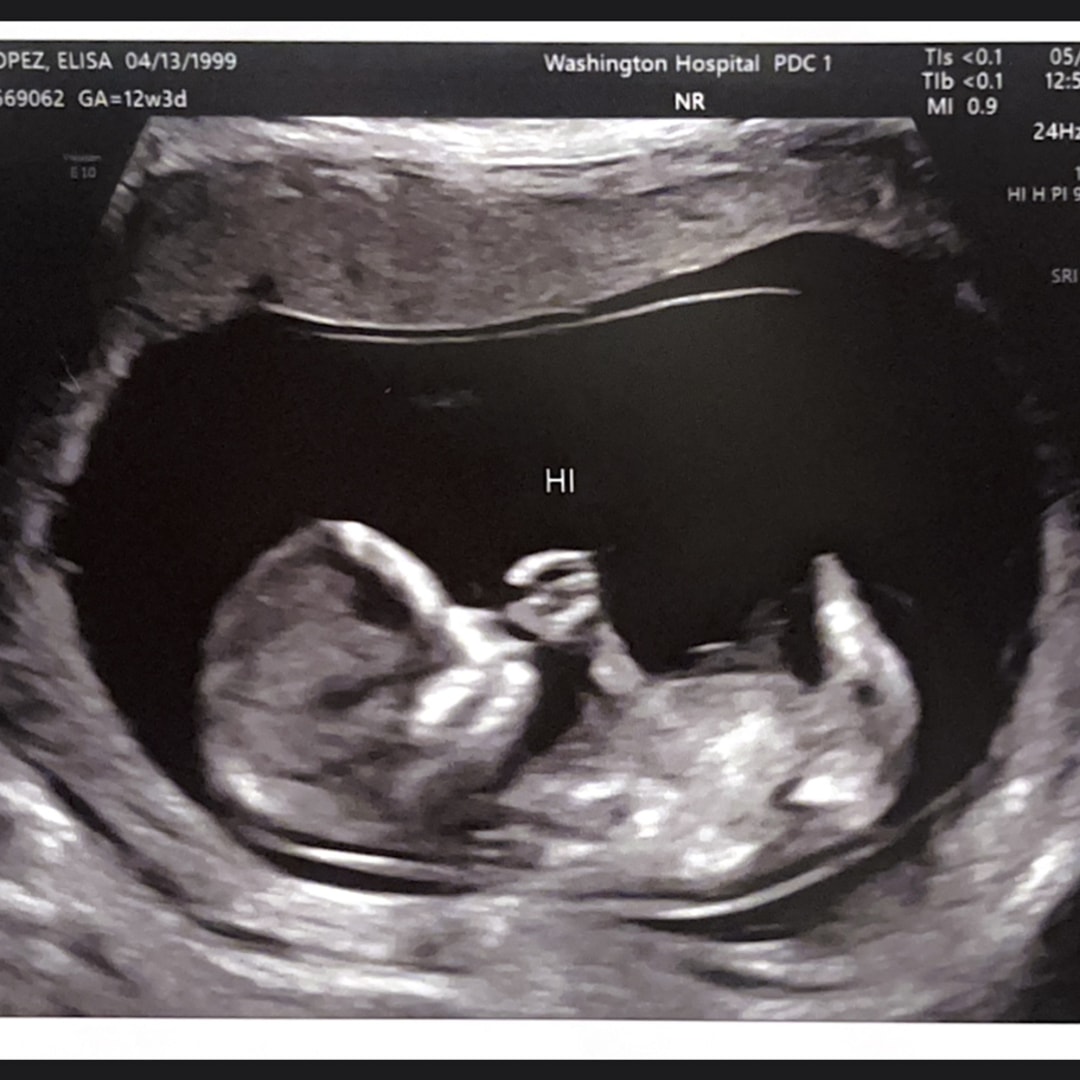Photo shared by Elisa for their Babylist baby registry.