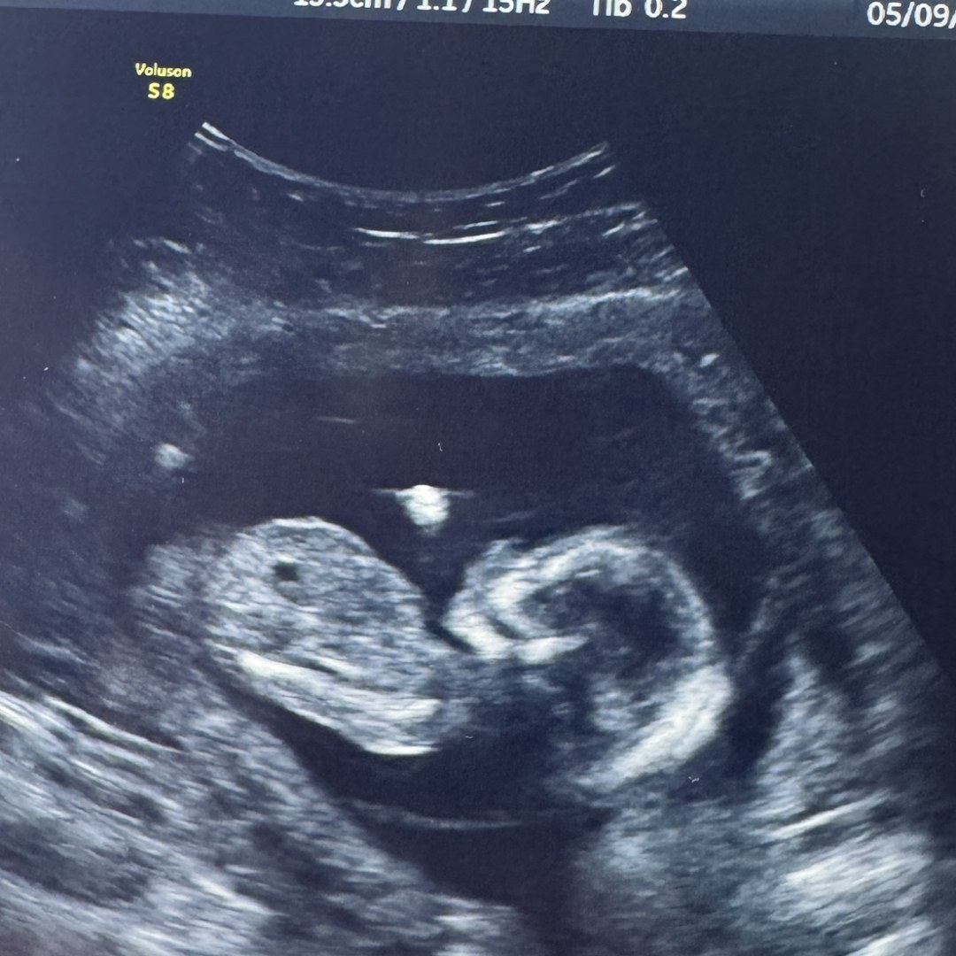 Photo shared by Tara for their Babylist baby registry.