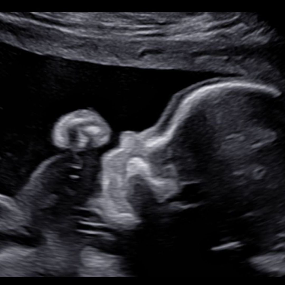 Photo shared by Heilly for their Babylist baby registry.