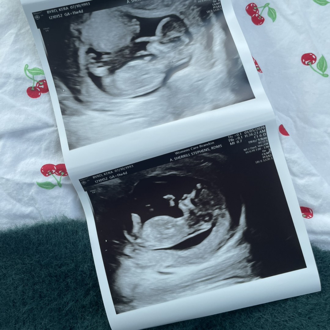 Photo shared by Kera for their Babylist baby registry.