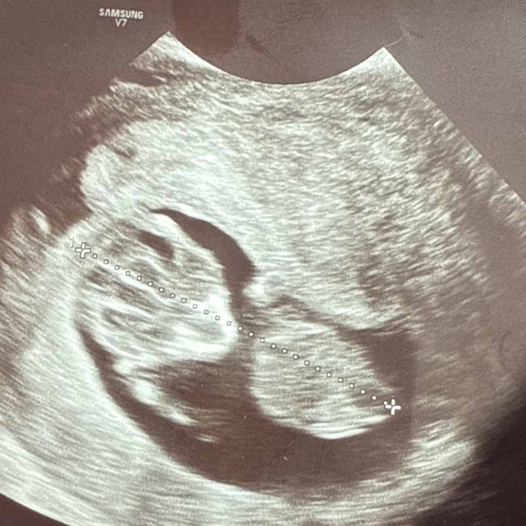 Photo shared by Jessica for their Babylist baby registry.