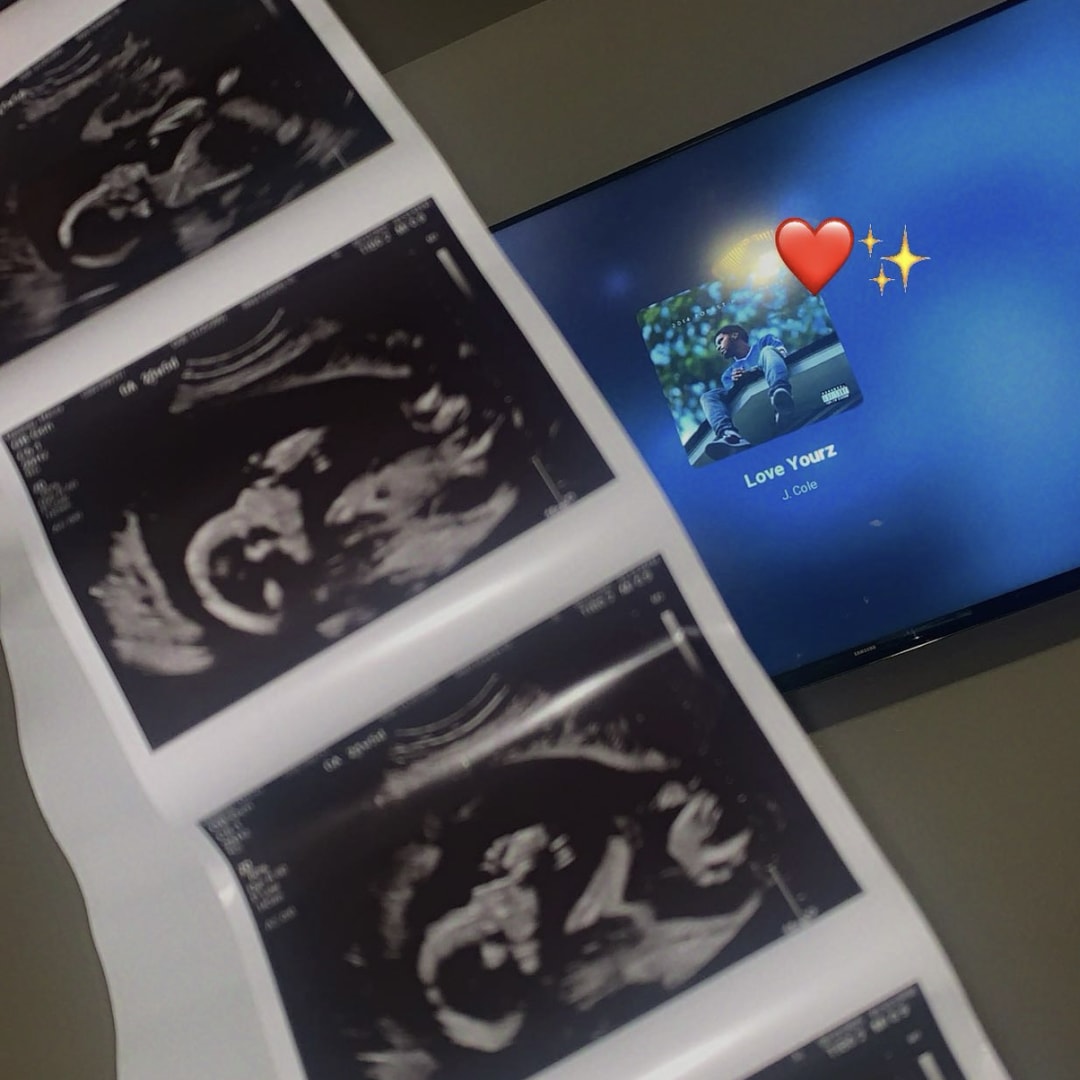 Photo shared by Marisa for their Babylist baby registry.