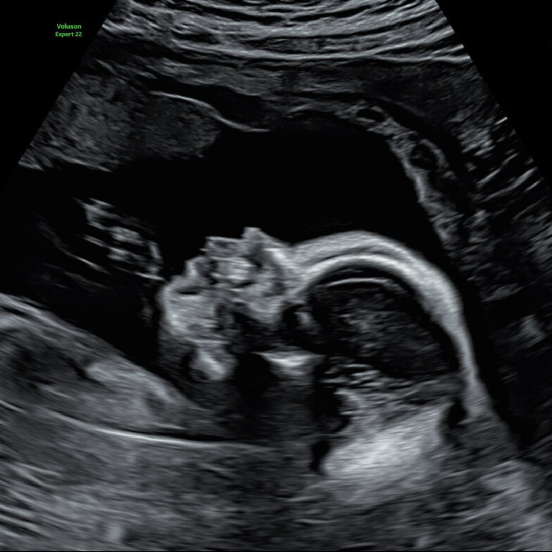 Photo shared by Madeline for their Babylist baby registry.