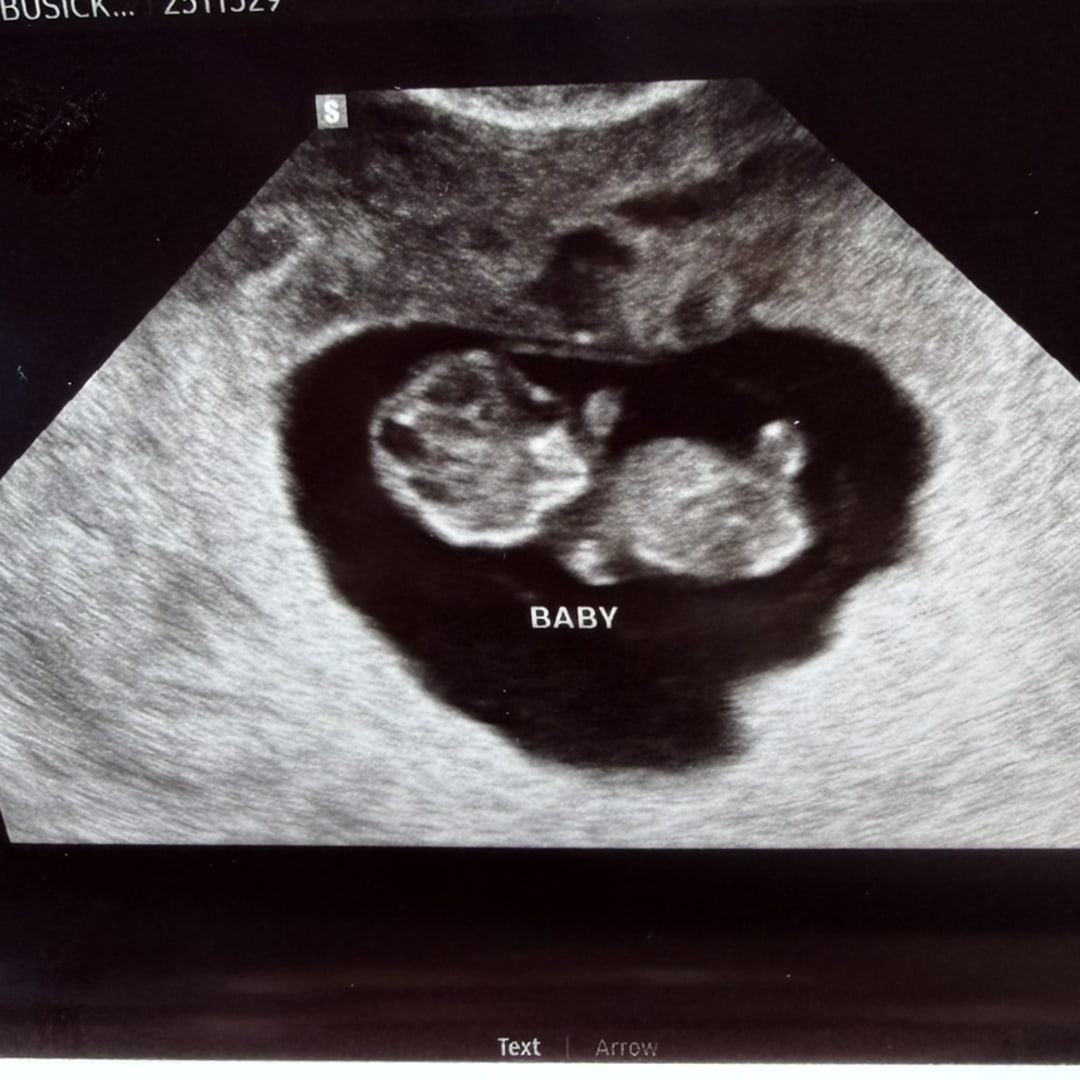 Photo shared by Carson for their Babylist baby registry.