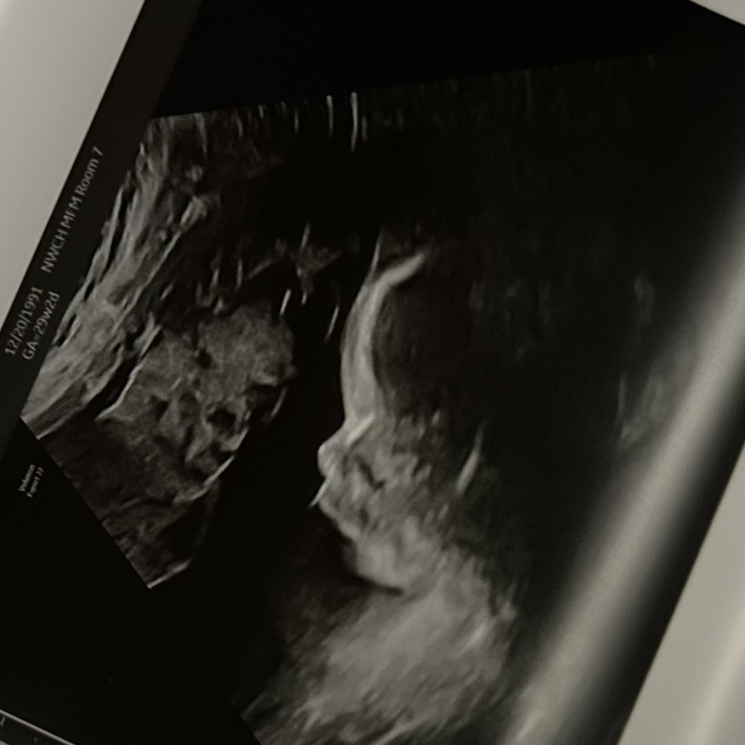 Photo shared by Lauren for their Babylist baby registry.