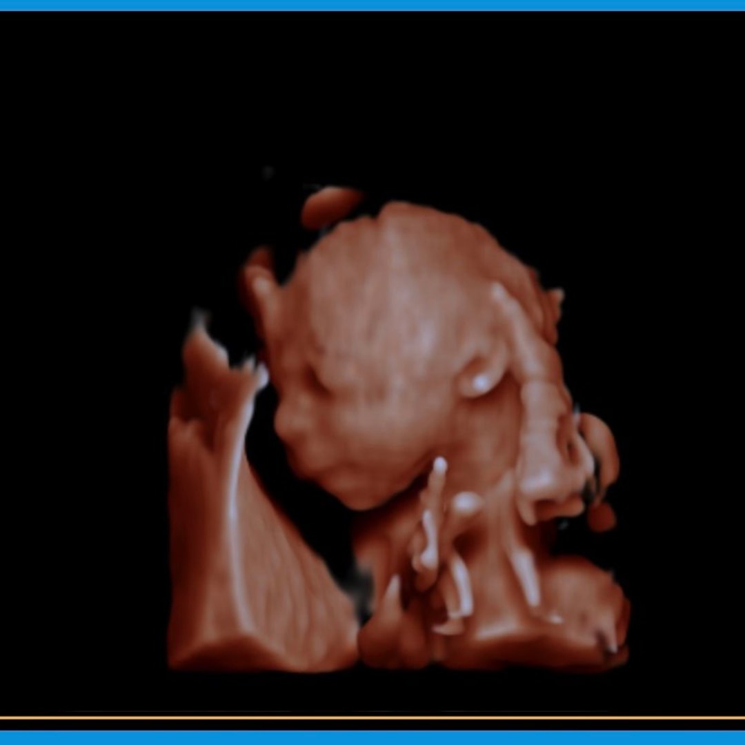 Photo shared by Kendall for their Babylist baby registry.