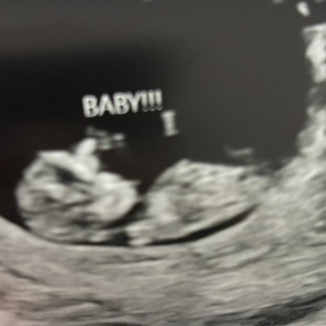Photo shared by Elizabeth for their Babylist baby registry.
