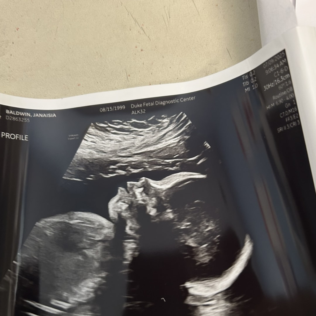 Photo shared by Janaisia for their Babylist baby registry.