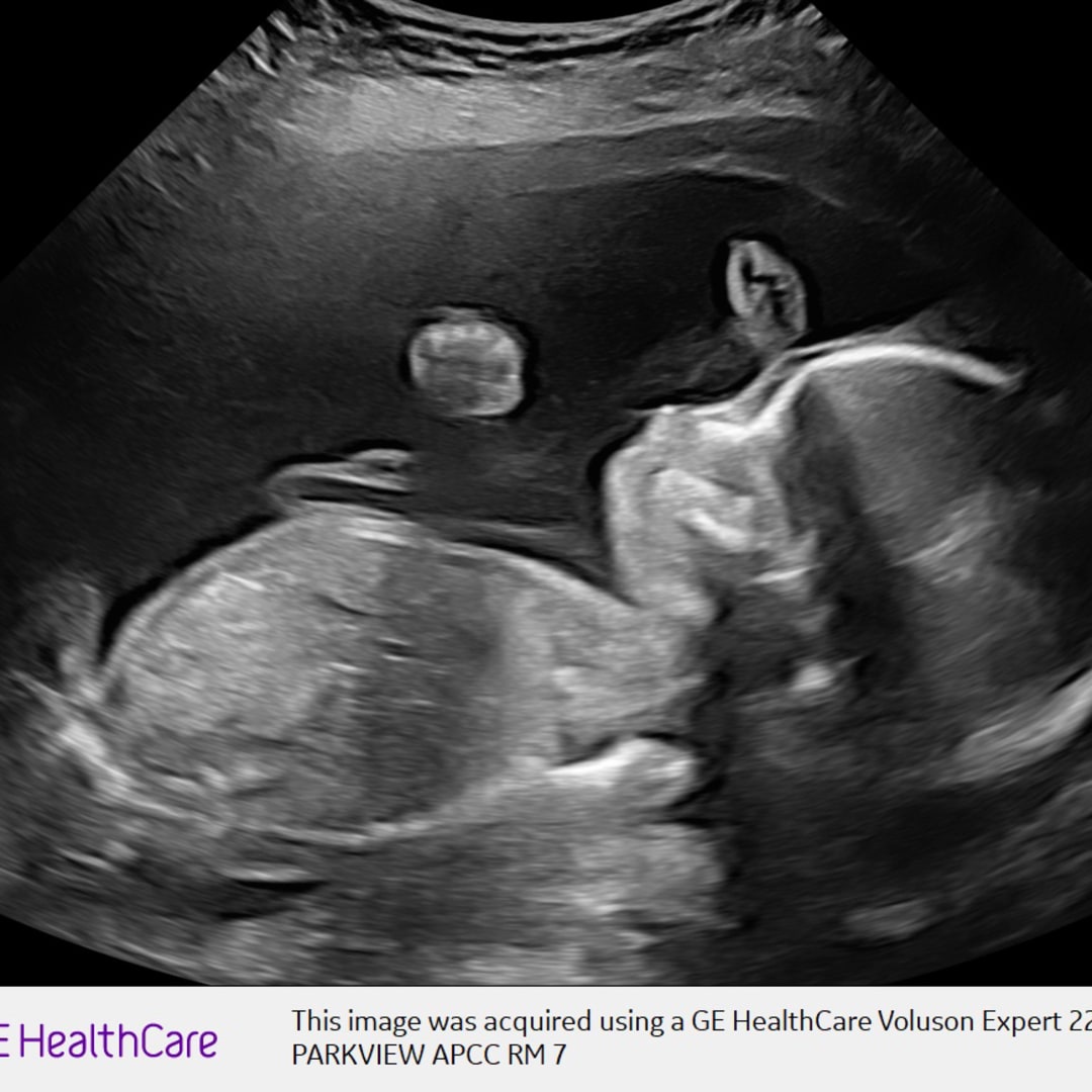 Photo shared by Ashley for their Babylist baby registry.
