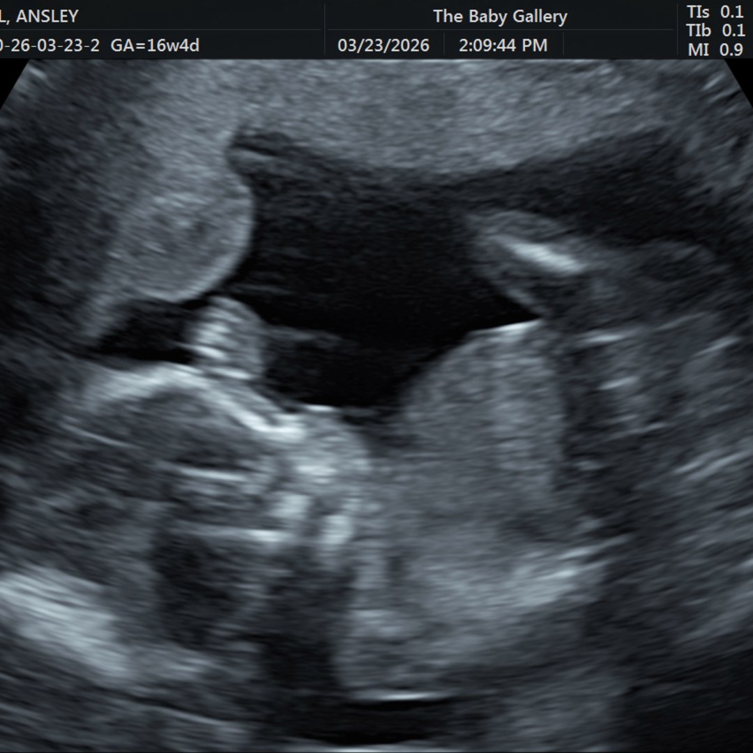 Photo shared by Ansley for their Babylist baby registry.