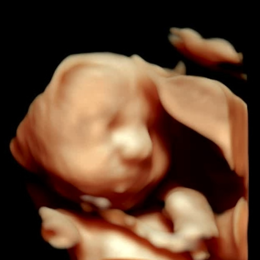Photo shared by Lauren for their Babylist baby registry.