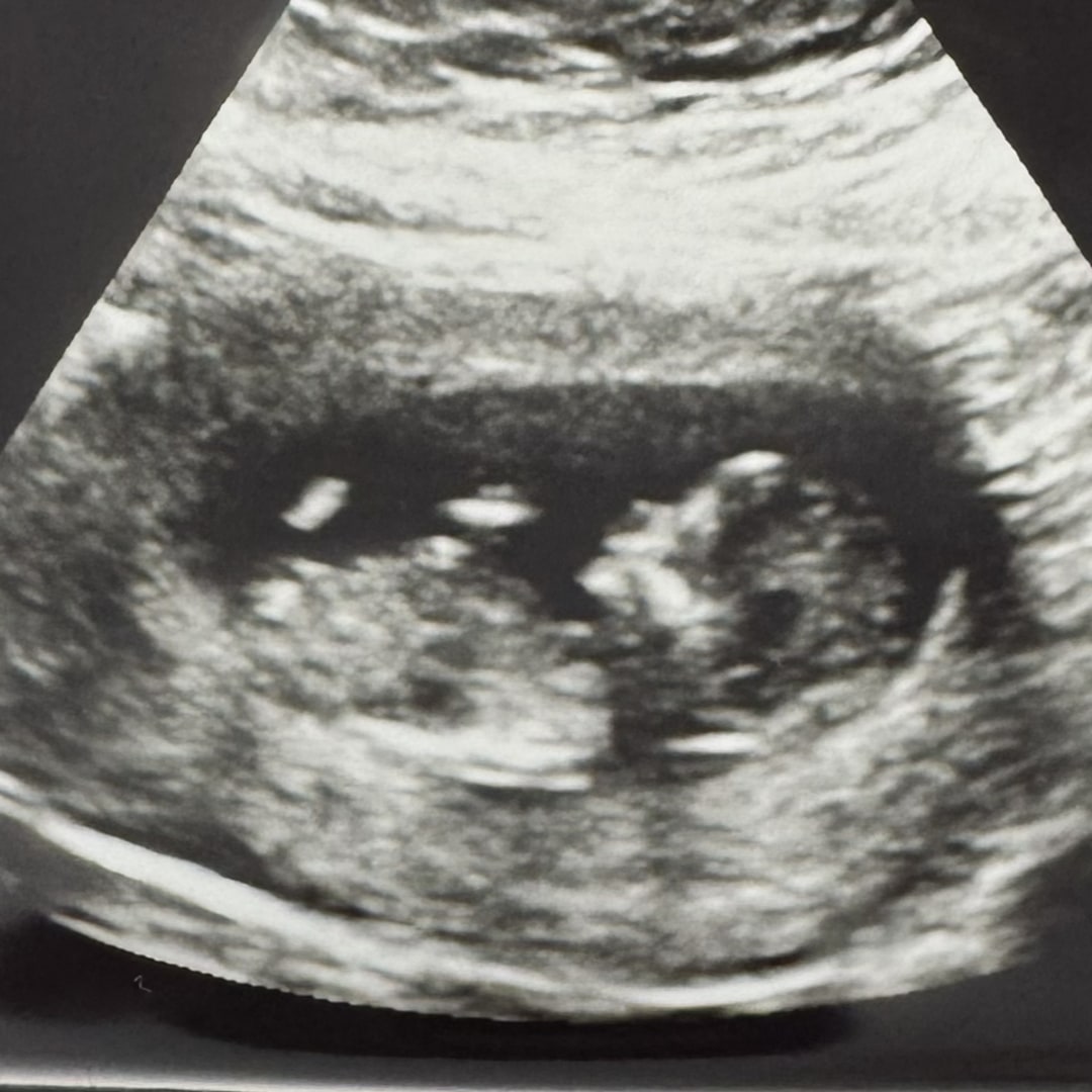 Photo shared by Brianna for their Babylist baby registry.