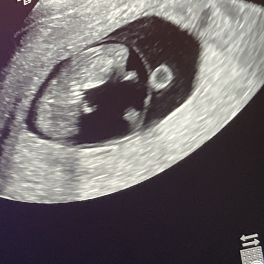 Photo shared by Madalyn for their Babylist baby registry.