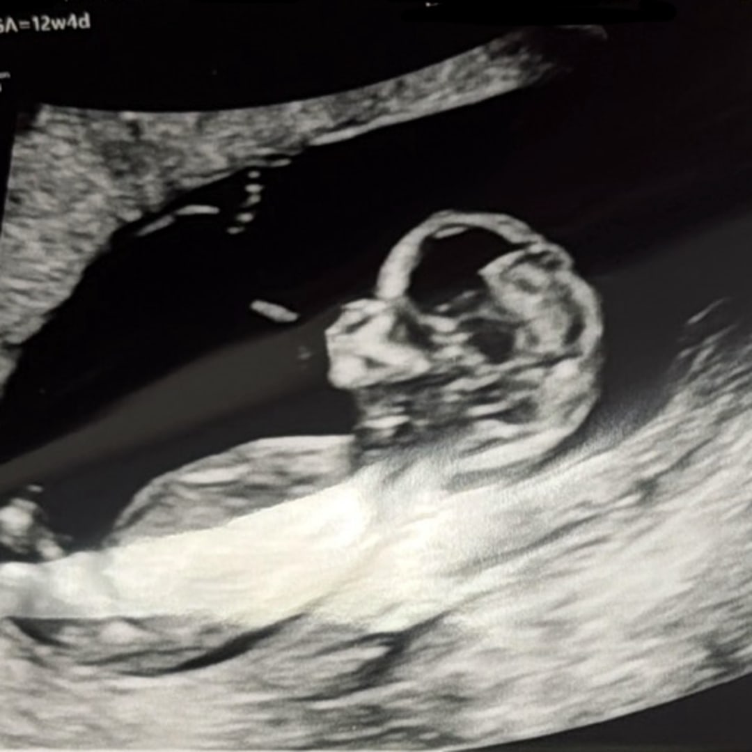 Photo shared by Massiel for their Babylist baby registry.