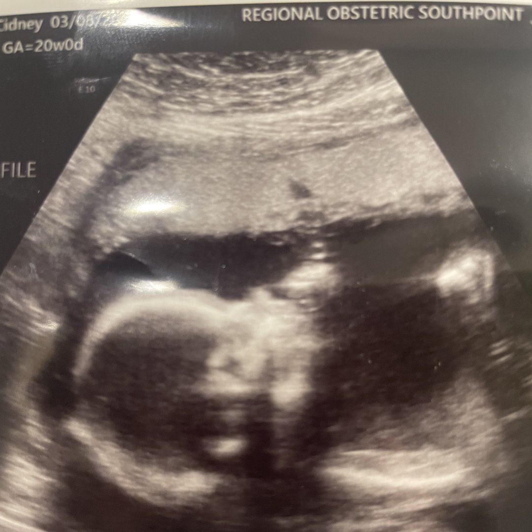 Photo shared by Cidney for their Babylist baby registry.