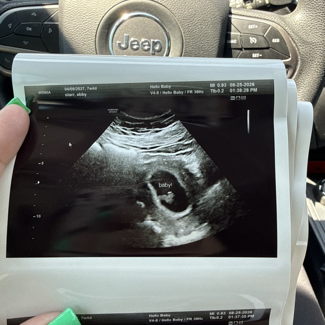 Photo shared by Abby for their Babylist baby registry.