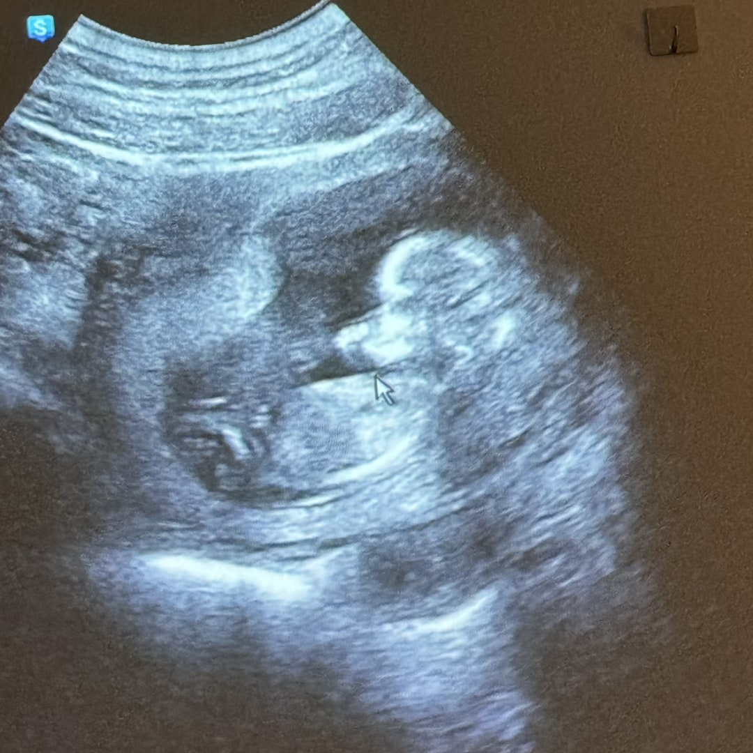 Photo shared by Makaila for their Babylist baby registry.