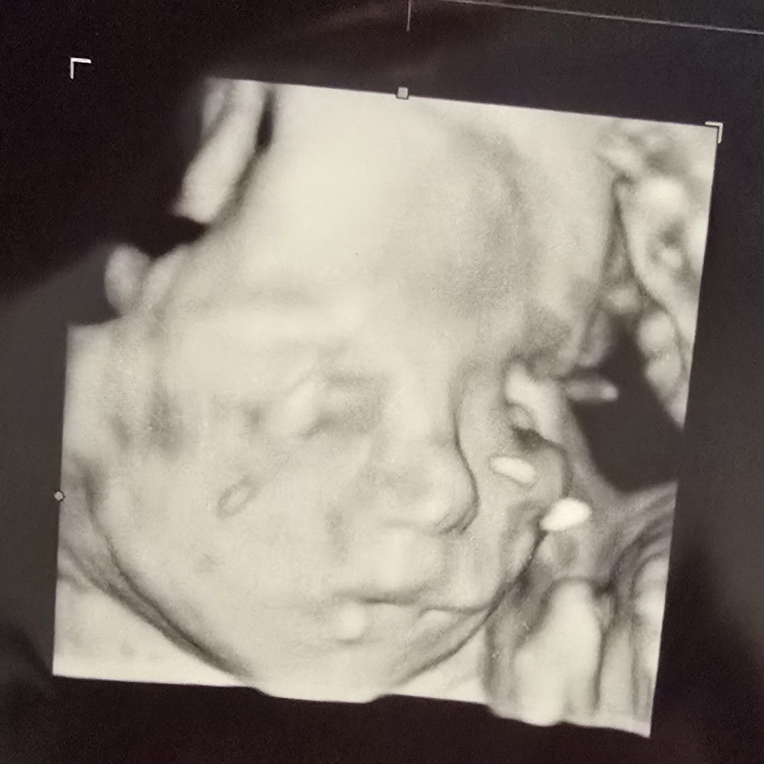 Photo shared by Michelle for their Babylist baby registry.