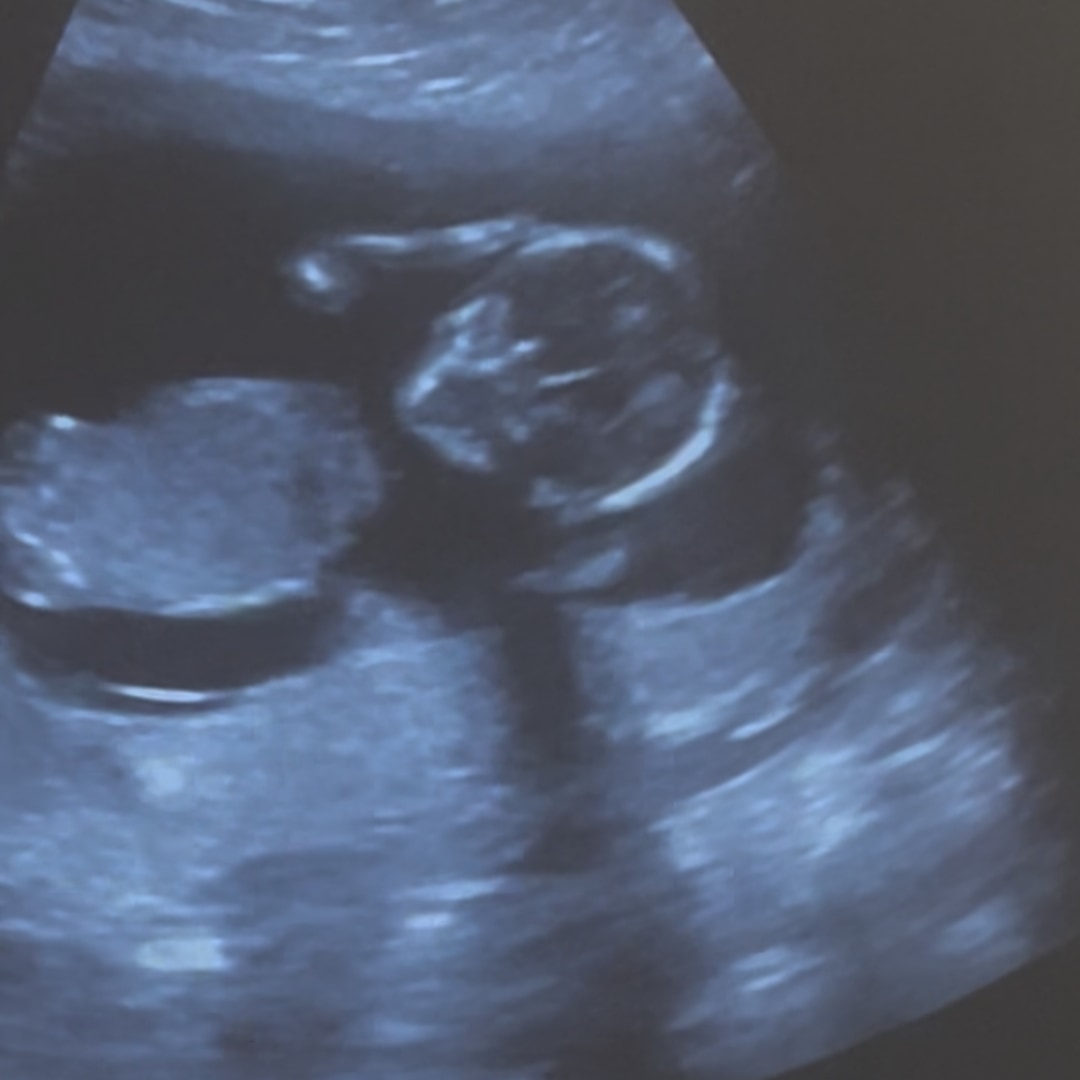 Photo shared by Ebony for their Babylist baby registry.