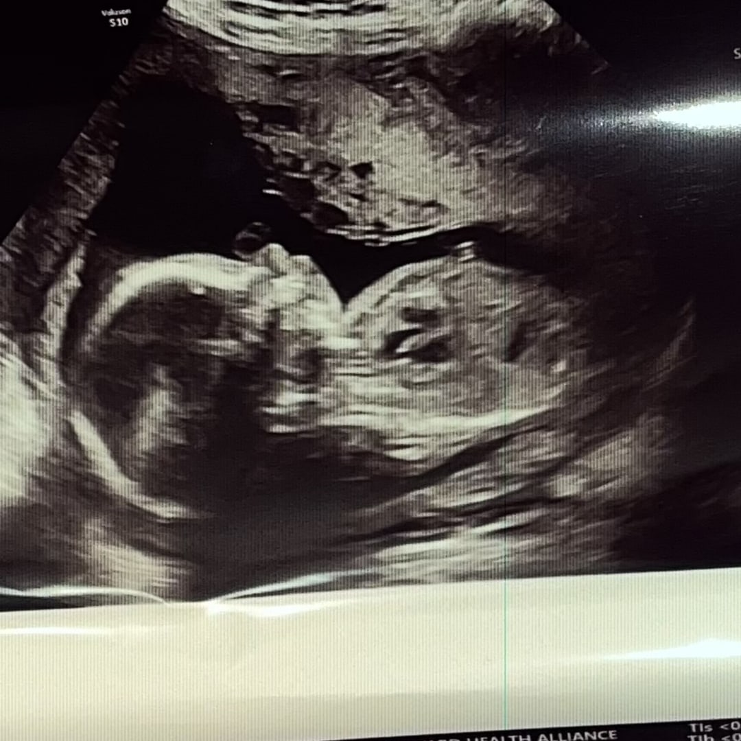 Photo shared by Nakayla for their Babylist baby registry.