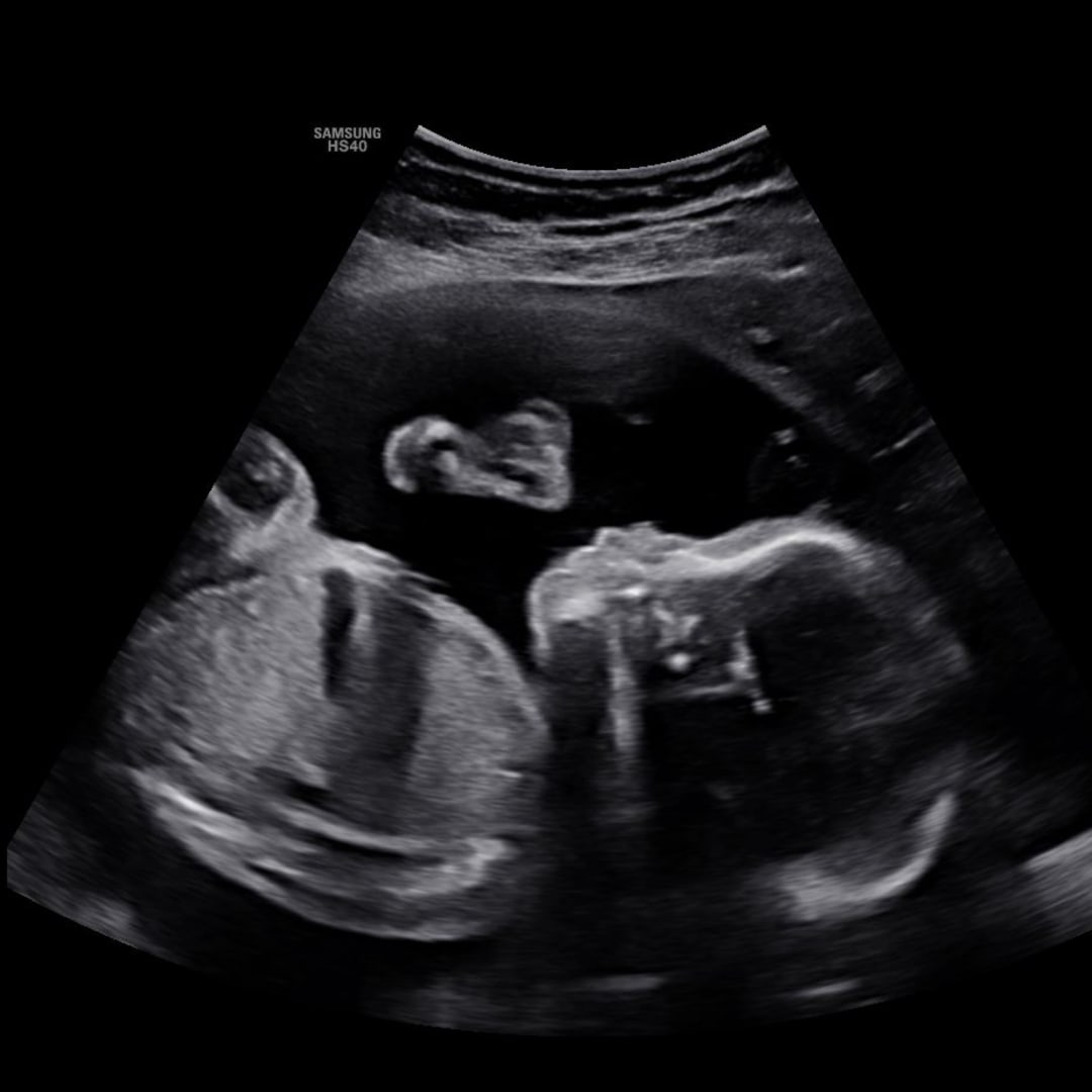 Photo shared by Ruth for their Babylist baby registry.