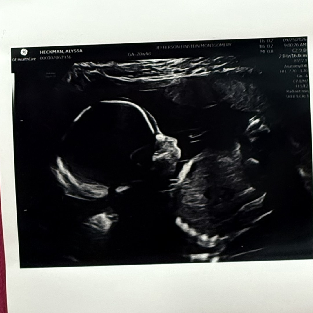 Photo shared by Alyssa for their Babylist baby registry.