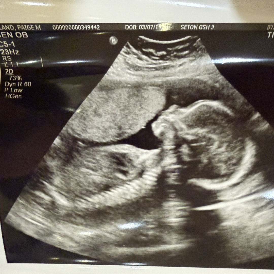 Photo shared by Paige for their Babylist baby registry.