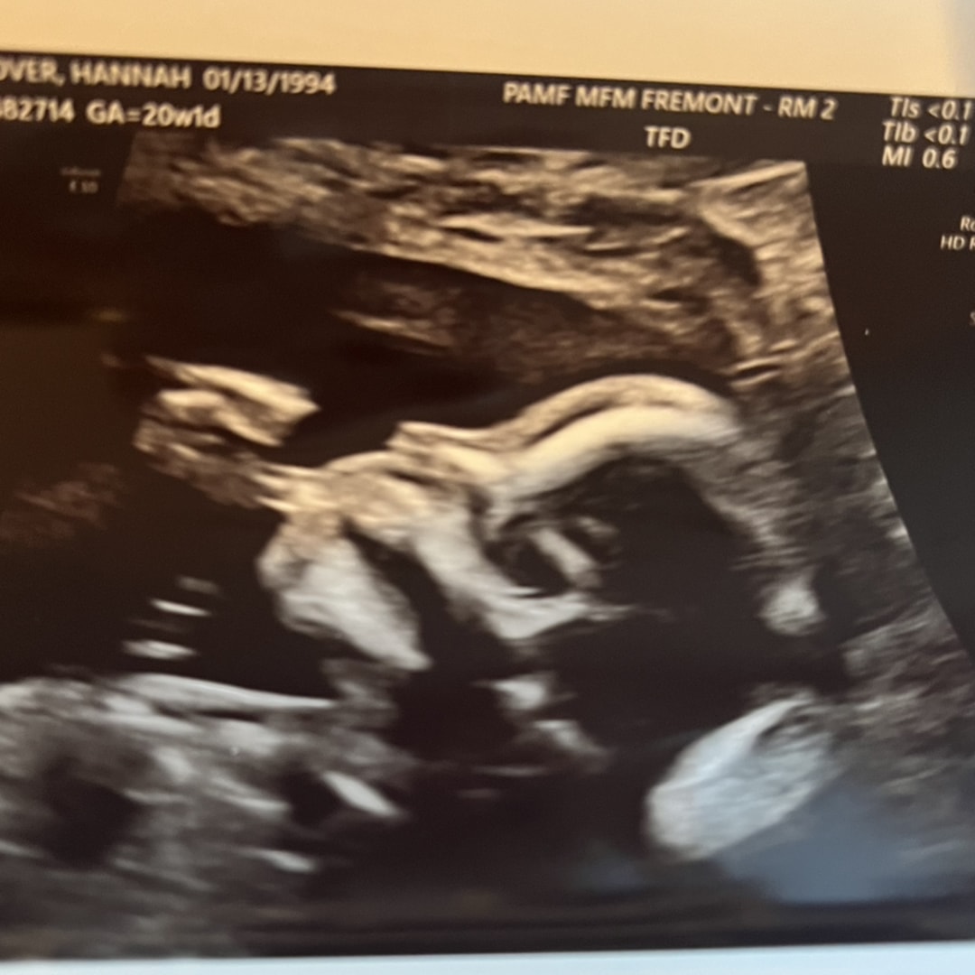 Photo shared by Hannah for their Babylist baby registry.