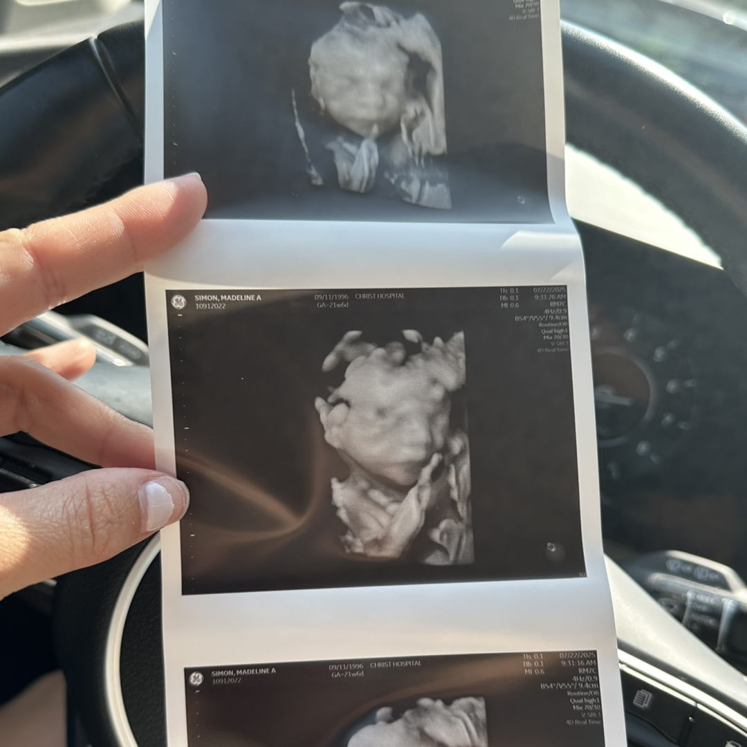 Photo shared by Madeline for their Babylist baby registry.