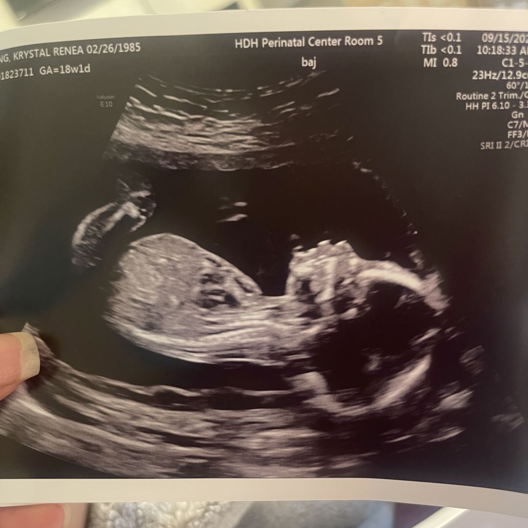 Photo shared by Kay for their Babylist baby registry.