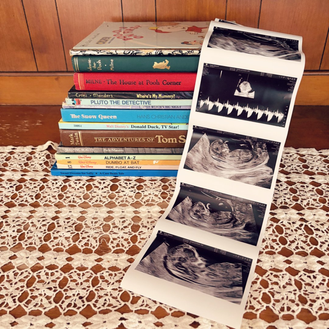 Photo shared by Rebecca for their Babylist baby registry.