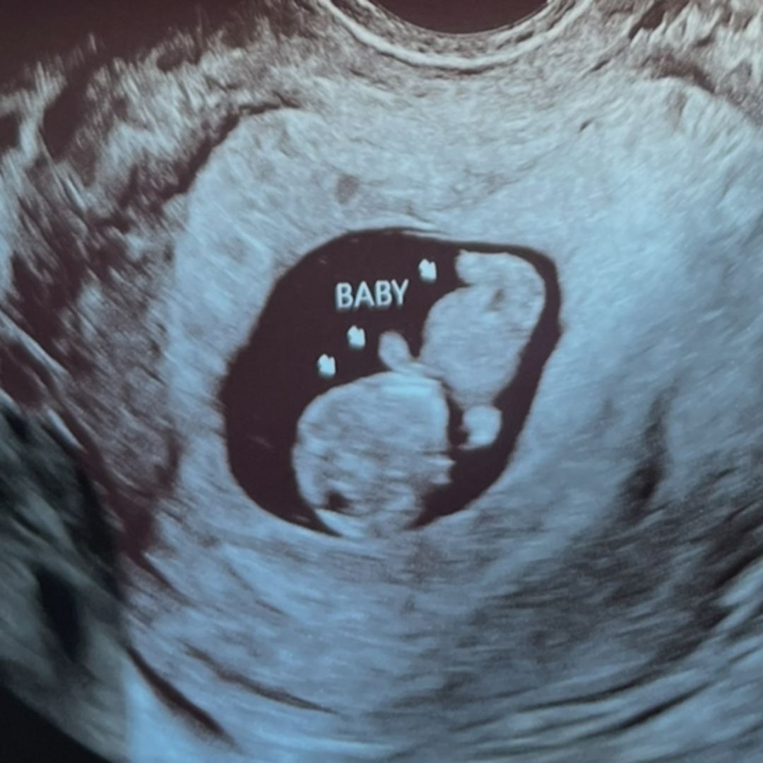 Photo shared by Tikina for their Babylist baby registry.