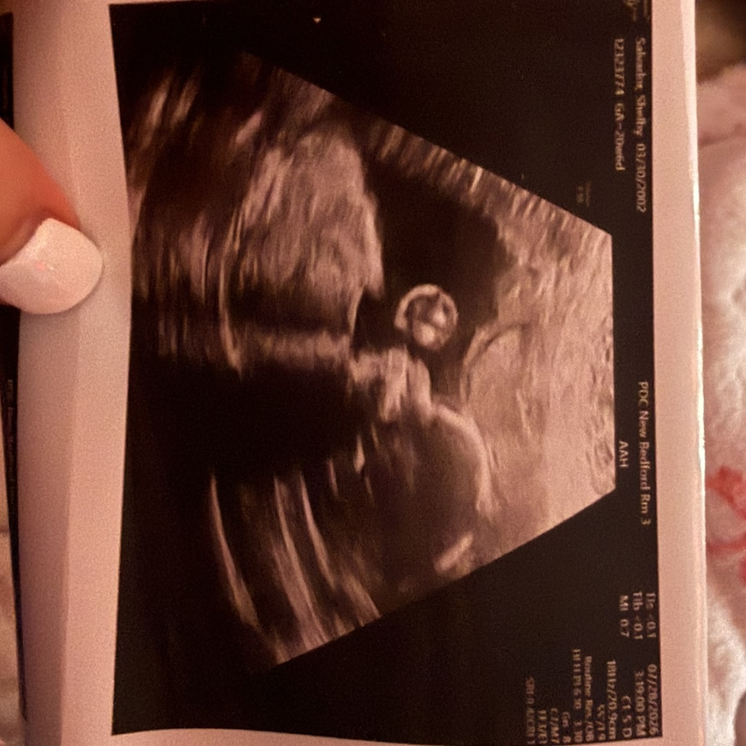 Photo shared by Shelby for their Babylist baby registry.