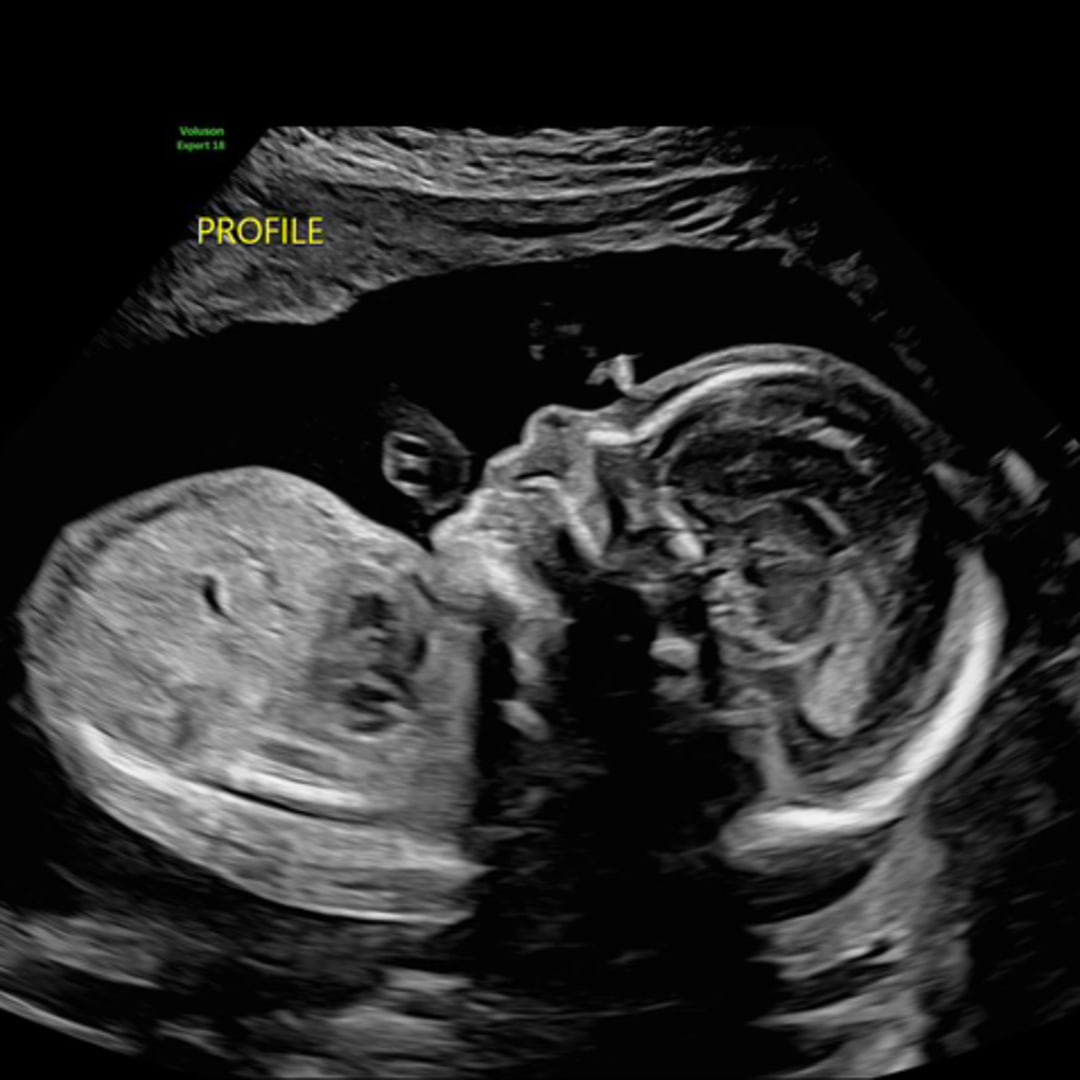 Photo shared by Amy for their Babylist baby registry.