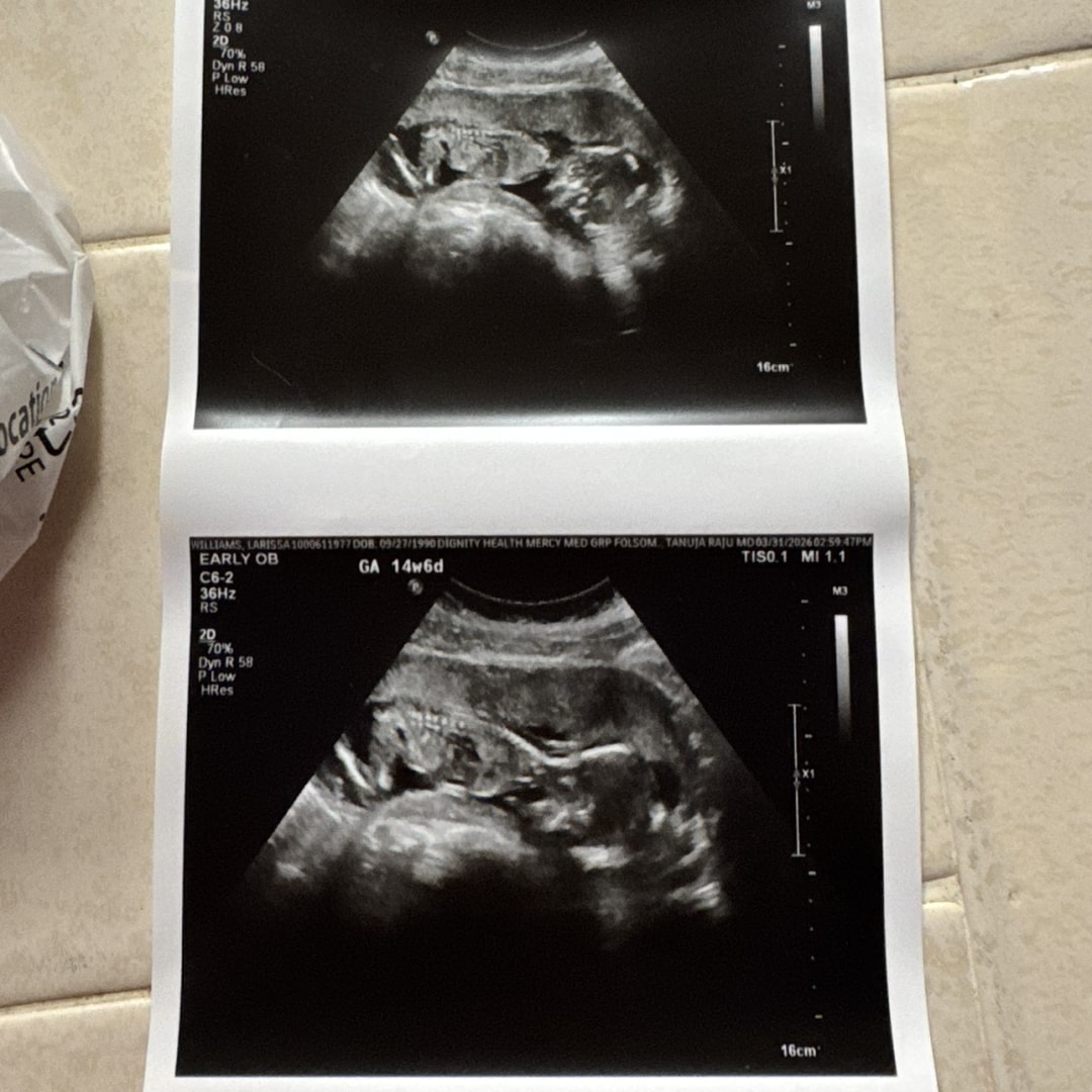 Photo shared by Larissa for their Babylist baby registry.