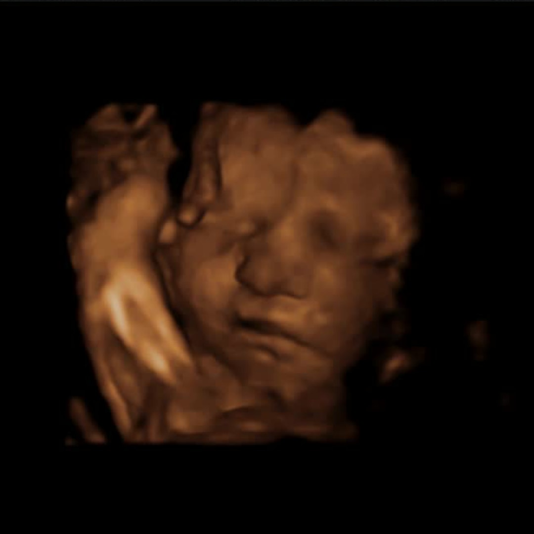 Photo shared by Allie for their Babylist baby registry.