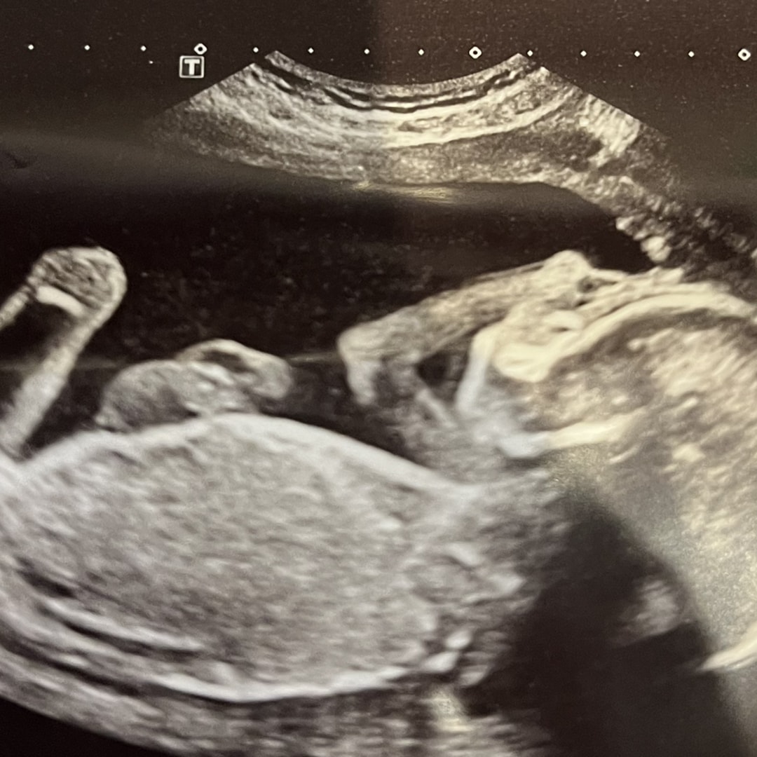 Photo shared by Andrea for their Babylist baby registry.