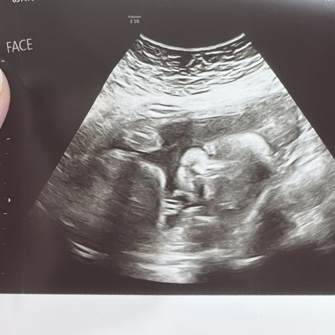 Photo shared by Jessie for their Babylist baby registry.