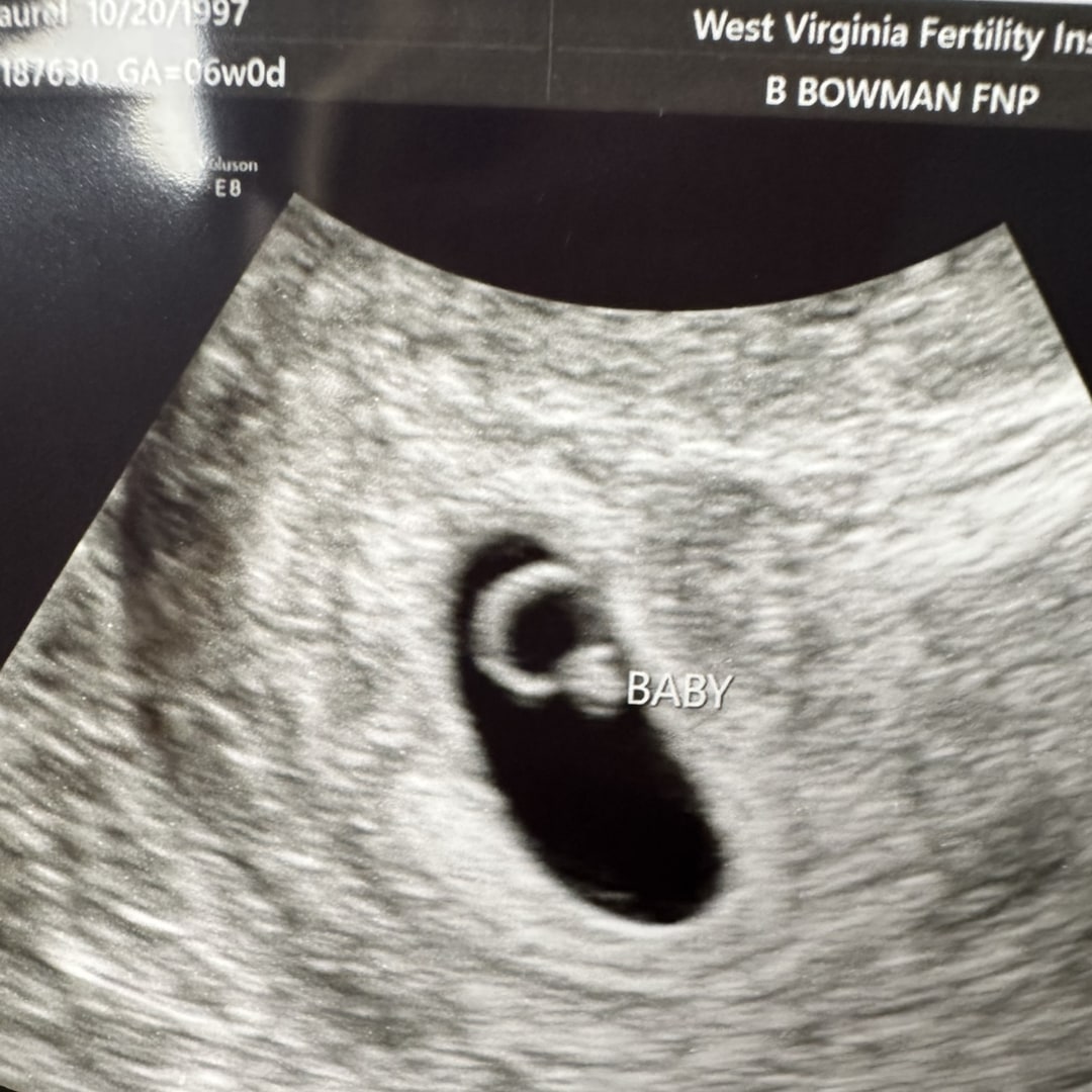 Photo shared by Laurel for their Babylist baby registry.