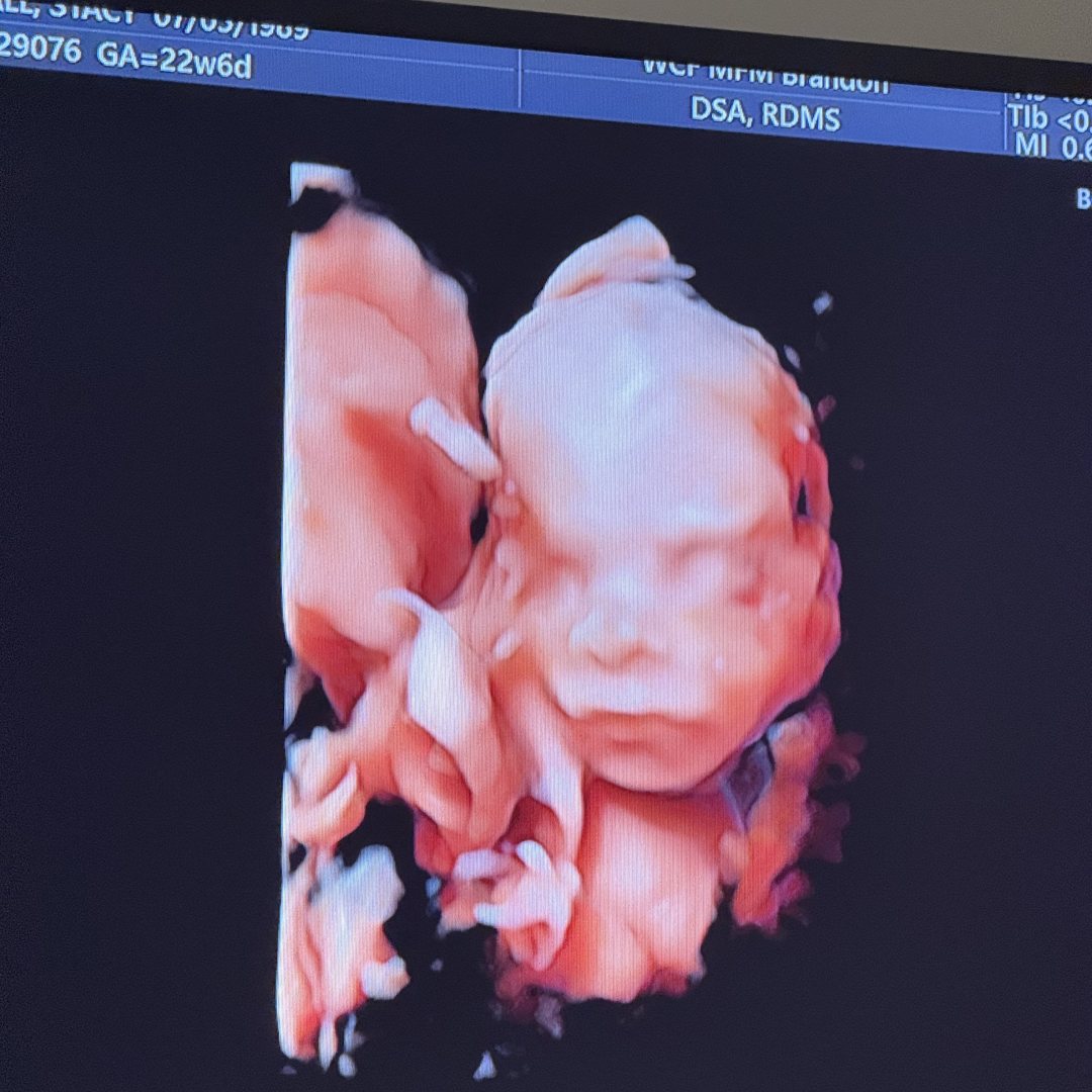 Photo shared by Stacy for their Babylist baby registry.