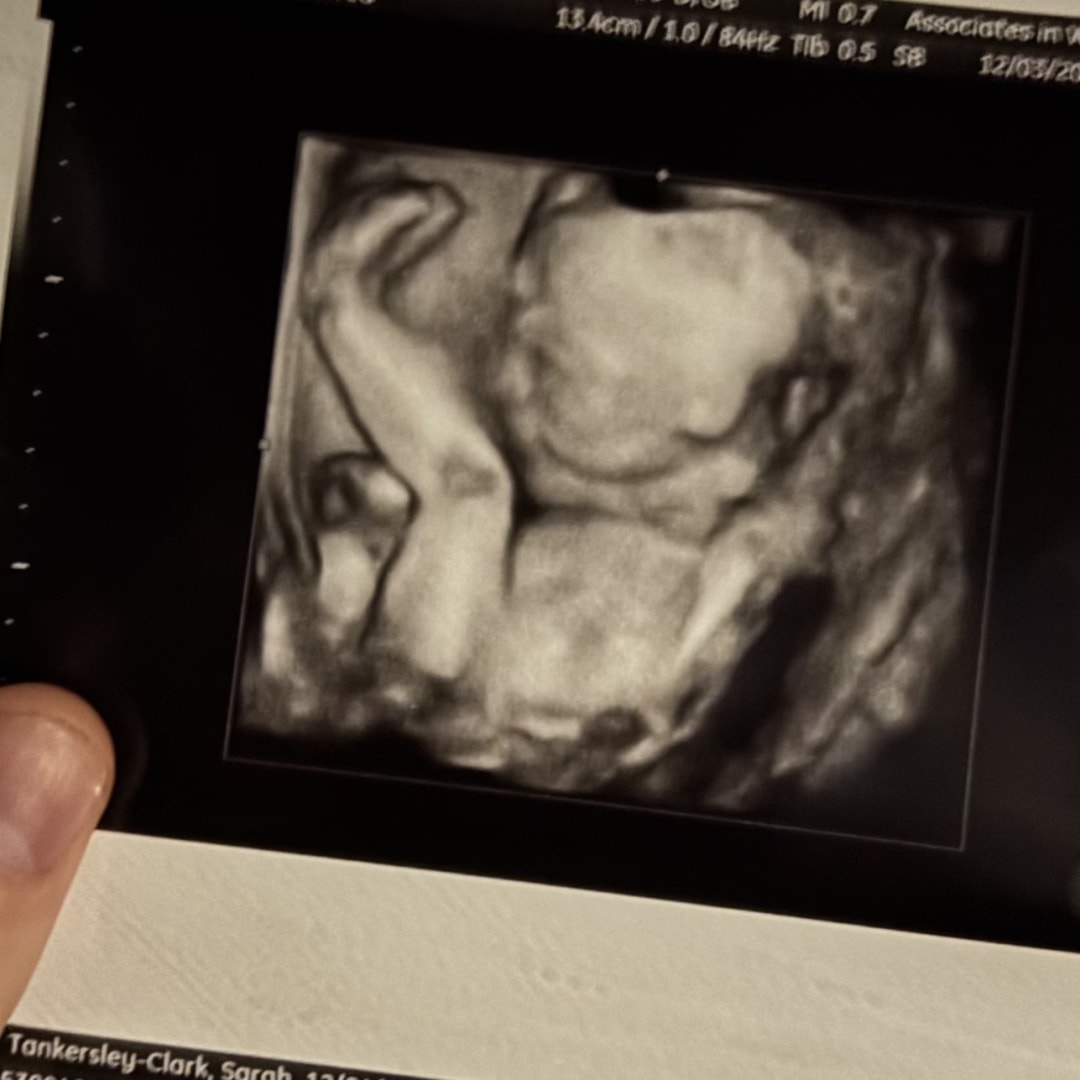 Photo shared by Sarah for their Babylist baby registry.