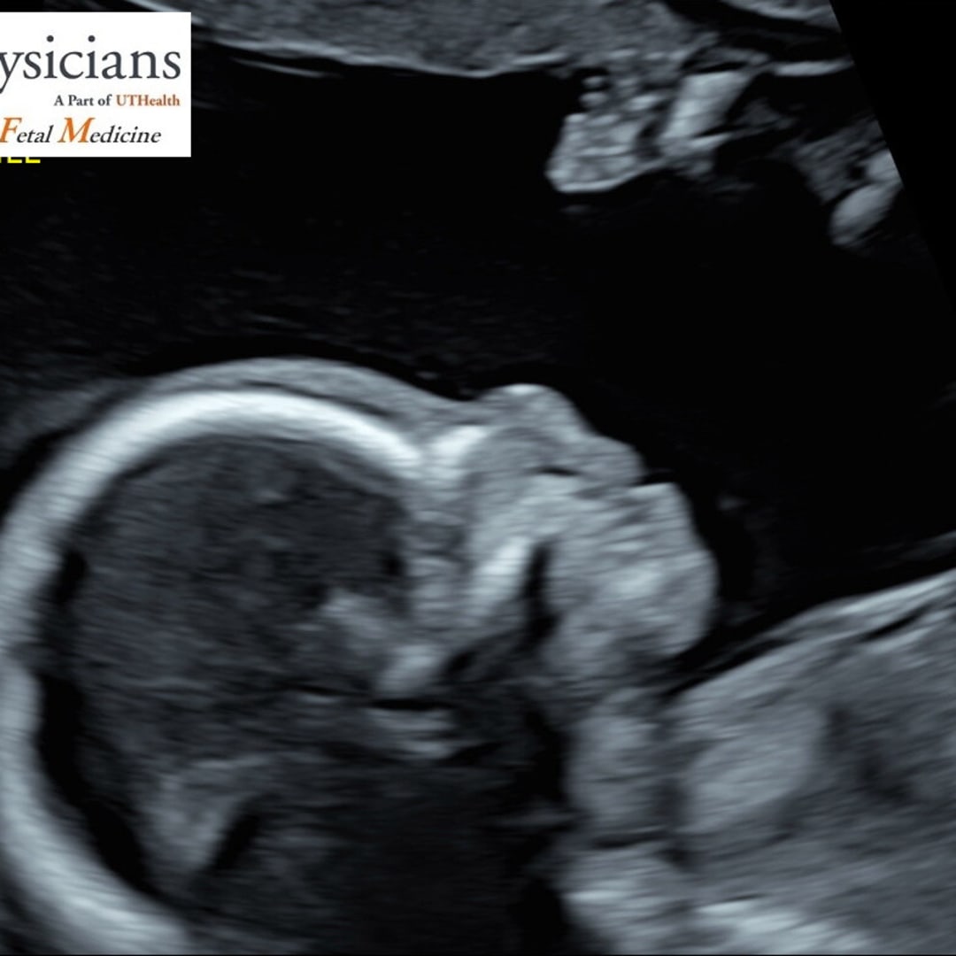 Photo shared by Alyssa for their Babylist baby registry.