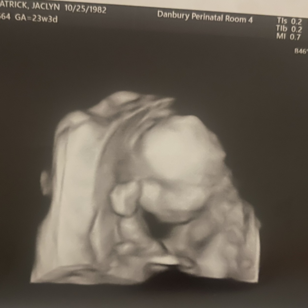 Photo shared by Jaclyn for their Babylist baby registry.