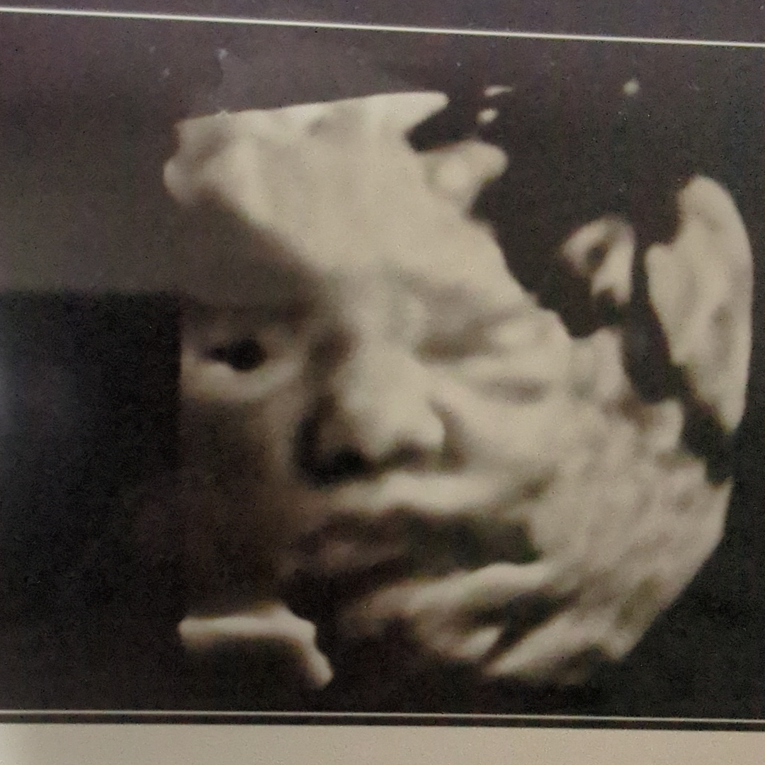 Photo shared by Katie for their Babylist baby registry.