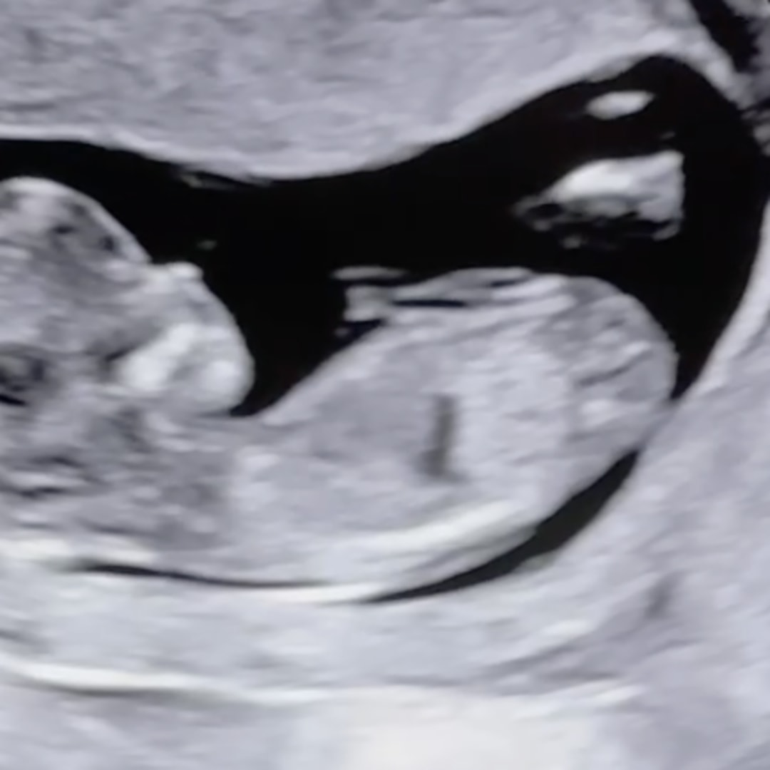 Photo shared by Katya for their Babylist baby registry.