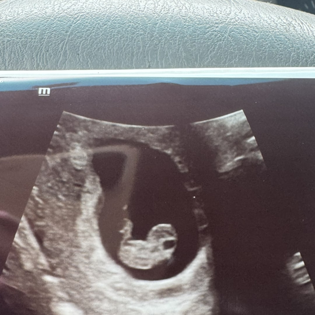 Photo shared by Amber for their Babylist baby registry.