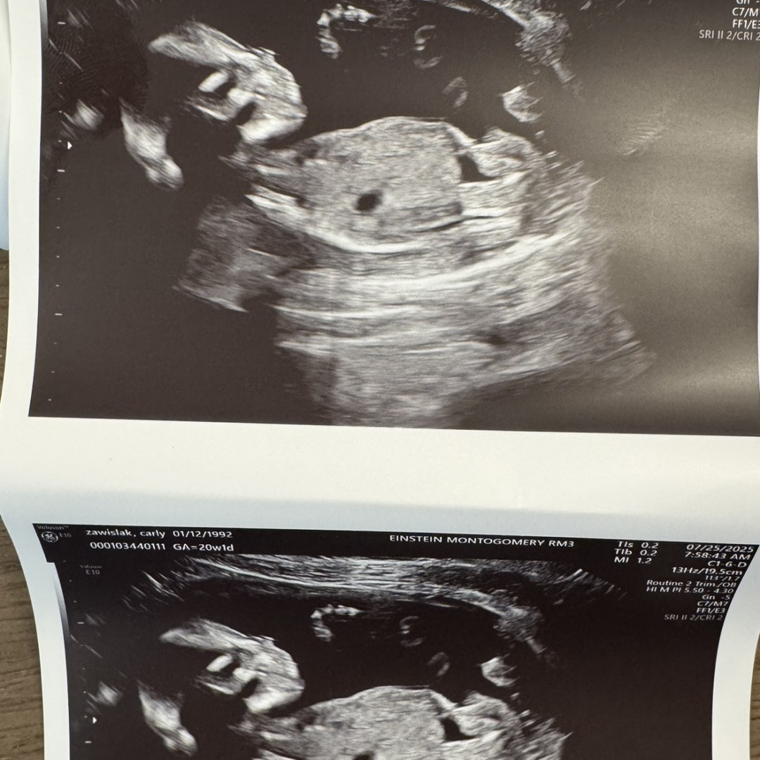 Photo shared by Carly for their Babylist baby registry.